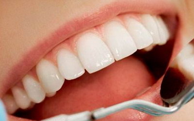 拔牙种植牙可以医保吗