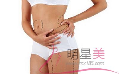 抽脂肚子<a href=http://www.washiqing.com/listinfo-687-0.html target=_blank class=infotextkey>减肥</a>价格