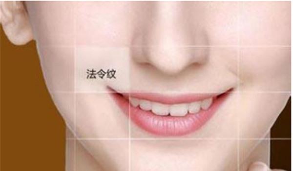 做悬吊<a href=http://www.washiqing.com/listinfo-614-0.html target=_blank class=infotextkey>除皱</a><a href=http://www.washiqing.com/listinfo-792-0.html target=_blank class=infotextkey>去法令纹</a>不适应人群有哪些