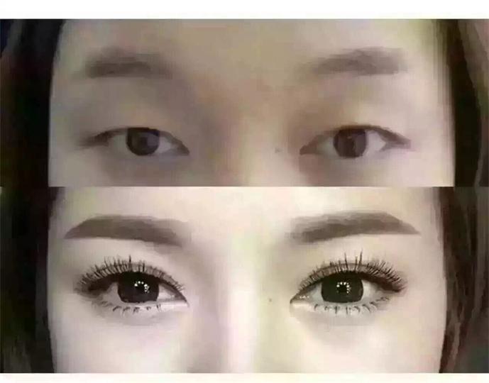 <a href=http://www.washiqing.com/listinfo-711-0.html target=_blank class=infotextkey>开眼角</a>和割<a href=http://www.washiqing.com/listinfo-724-0.html target=_blank class=infotextkey>双眼皮</a>恢复