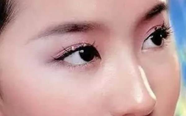 微创点压式<a href=http://www.washiqing.com/listinfo-724-0.html target=_blank class=infotextkey>双眼皮</a>手术费用是多少