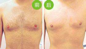 <a href=http://www.washiqing.com/listinfo-670-0.html target=_blank class=infotextkey>脱毛</a>到底哪种方法好