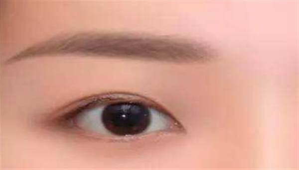 <a href=http://www.washiqing.com/listinfo-655-0.html target=_blank class=infotextkey>切眉</a>刀口发红用什么药
