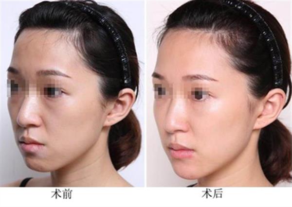 哪些人不适合做光子<a href=http://www.washiqing.com/listinfo-770-0.html target=_blank class=infotextkey>嫩肤</a>呢
