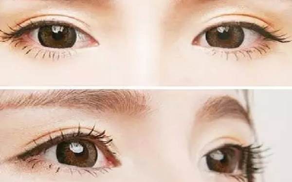 杭州眼部<a href=http://www.washiqing.com/listinfo-4-0.html target=_blank class=infotextkey>整形医院</a>哪儿好