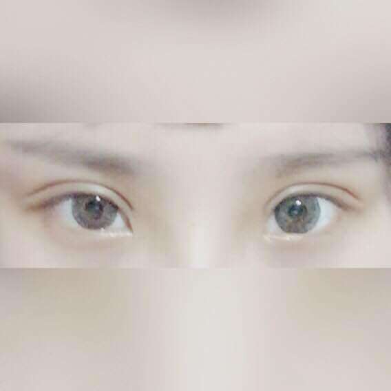 割<a href=http://www.washiqing.com/listinfo-724-0.html target=_blank class=infotextkey>双眼皮</a>15天能化妆吗